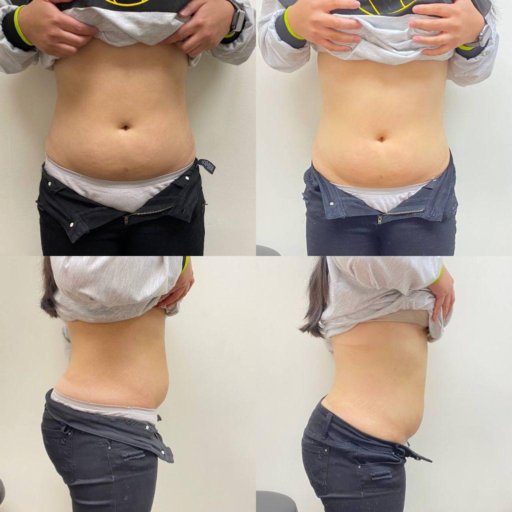 Body Contouring Specialist The Image Center