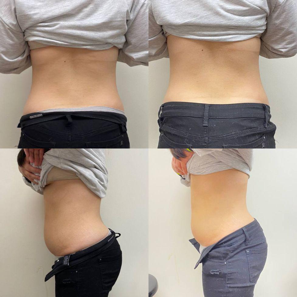 Body Contouring Specialist The Image Center