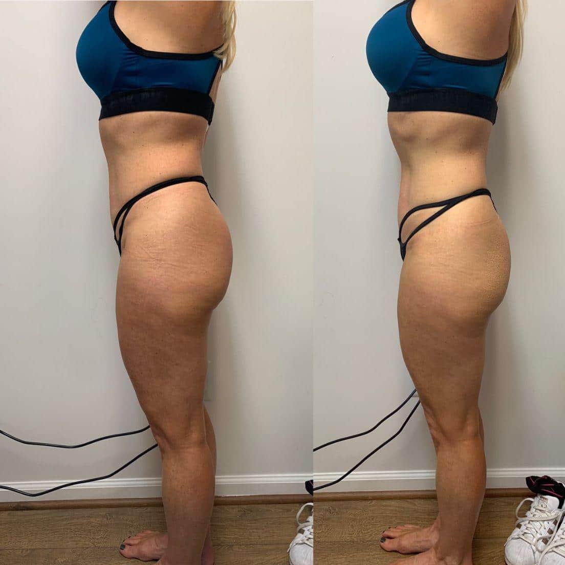 Body Contouring Specialist The Image Center